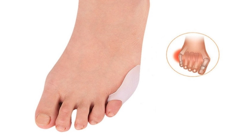 کفش تنگ و عوارض آن